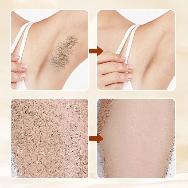 Buy 1 Get 1 FreeVersatile, Aromatic, Mild Formula Hair Removal Cream